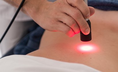 Laserterapia Aplicada a Disfunções Uroginecológicas e Proctológicas